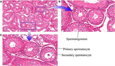 Characterization of N6-methyladenosine in cattle-yak testis tissue